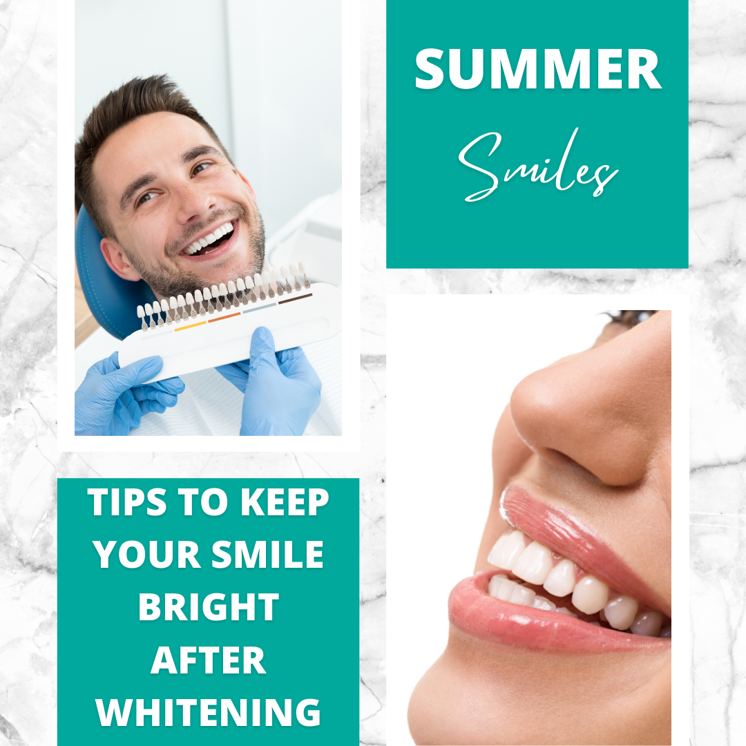 Summer Smiles: Tips to Keep Your Smile Bright After ...